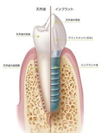 噛み合わせ