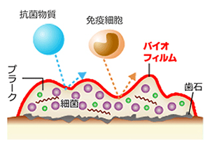 バイオフィルム